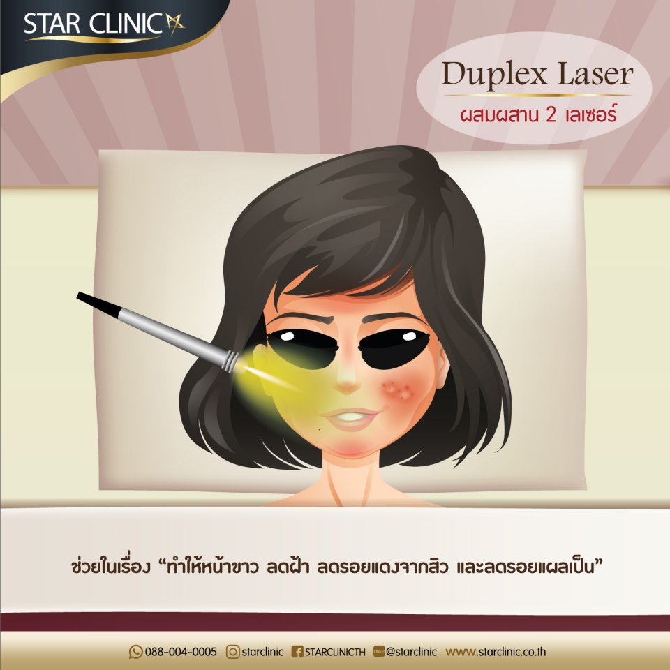 Duplex Laser