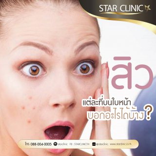 ตำแหน่งสิวบนใบหน้า บอกอะไรเราได้บ้างนะ?