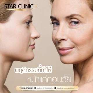 พฤติกรรมที่ทำให้หน้าแก่กอนวัย