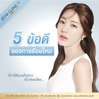 5 ข้อดีของการร้อยไหม 