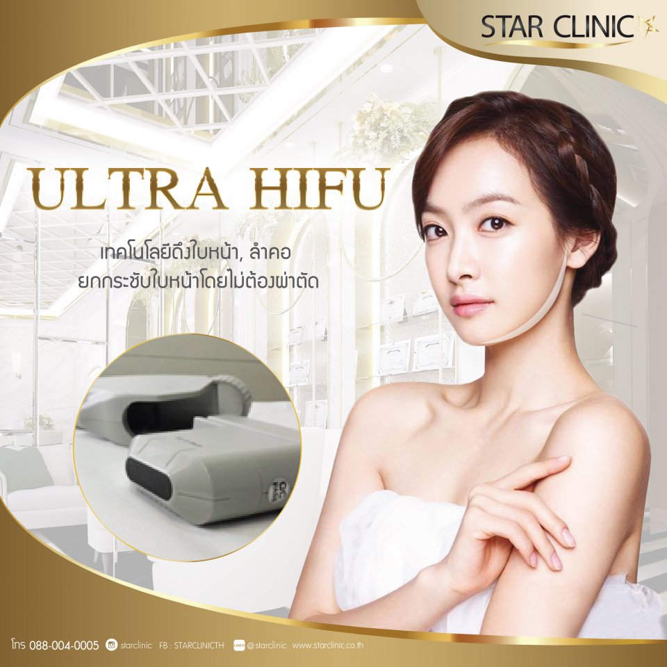 UltraHIFUยกกระชับลดริ้วรอยของใบหน้า