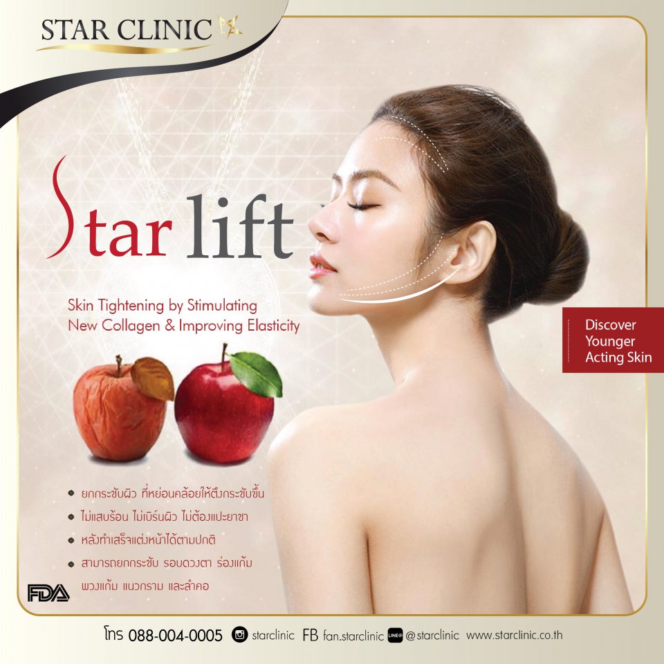 Star Lift ยกกระชับใบหน้า