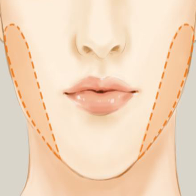 Buccal fat pad