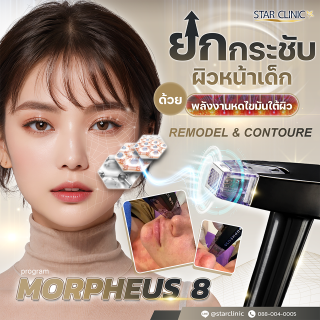 Morpheus8 เทคโนโลยียกกระชับ