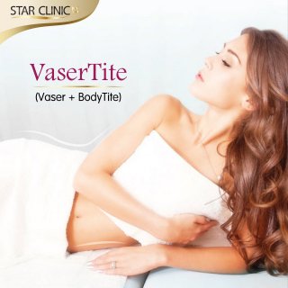 VaserTite (VASER + BodyTite) 