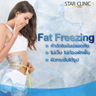 Fat Freezing สลายไขมันด้วยความเย็น