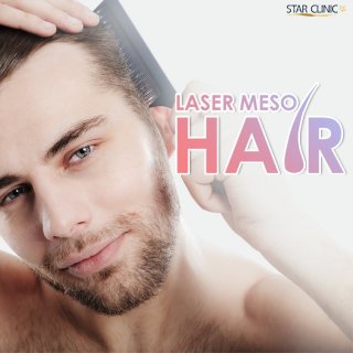 Laser Meso Hair