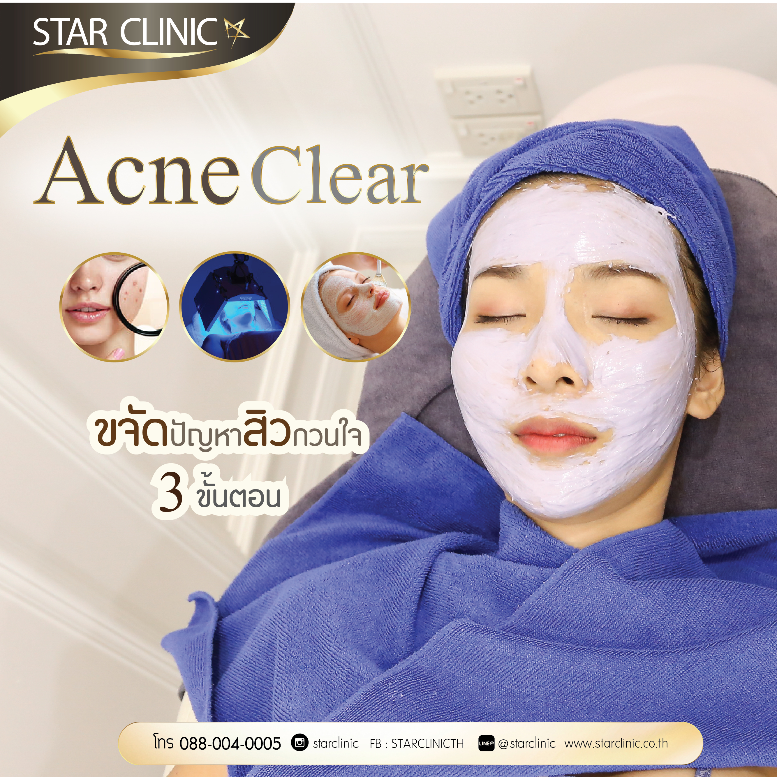 รีวิวน้องโดนัท กับ Acne Clear