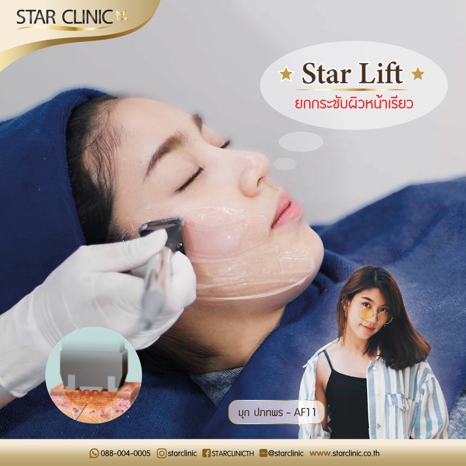 Star Lift Review