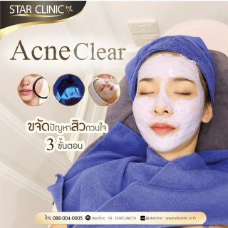 เมื่อมาบอกลาสิวที่ Star Clinic