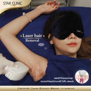 Laser Hair Removal 3