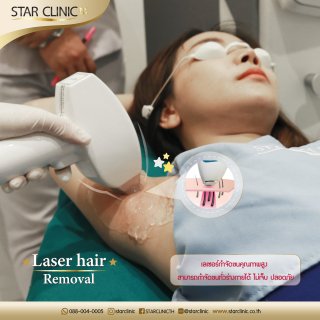 Laser Hair Removal 1